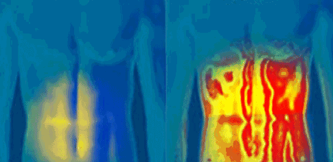 明星健身女瘦大腿图片_瘦大腿的照片_瘦大腿最有效的健身操