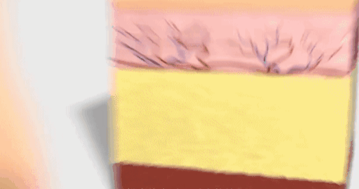 瘦大腿的照片_明星健身女瘦大腿图片_瘦大腿最有效的健身操